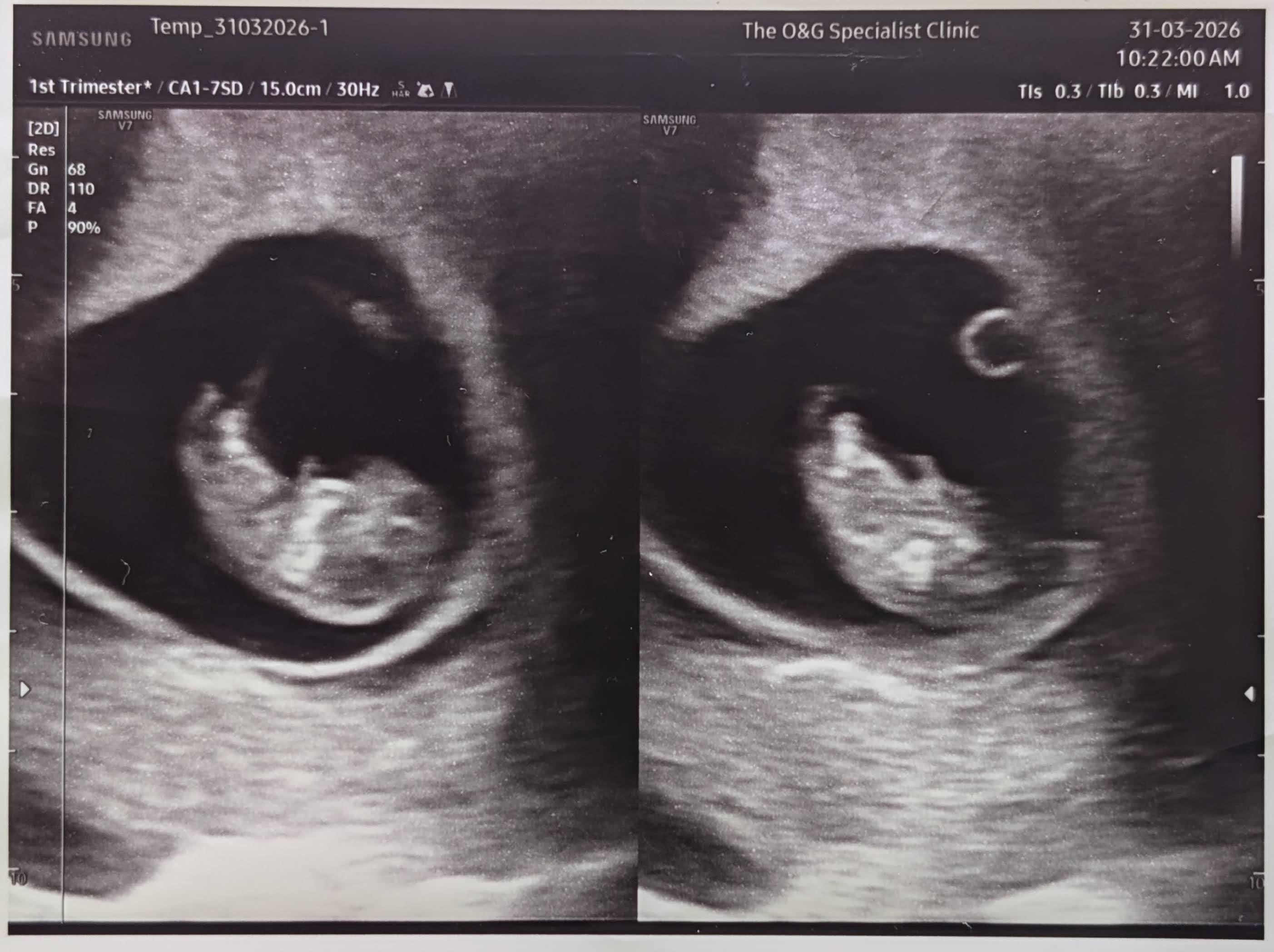 Ultrasound image